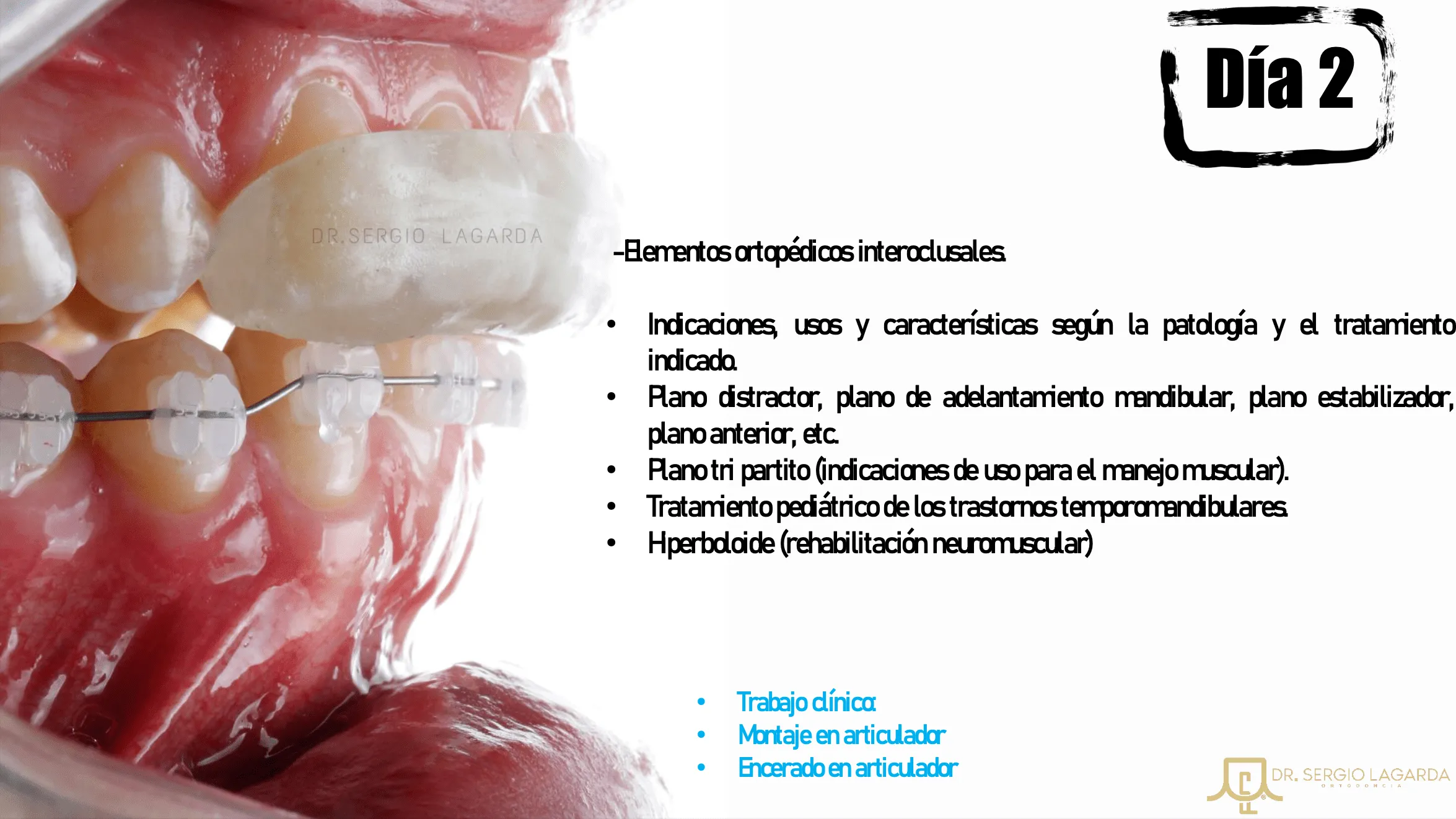 FIBRINA RICA EN PLAQUETAS 