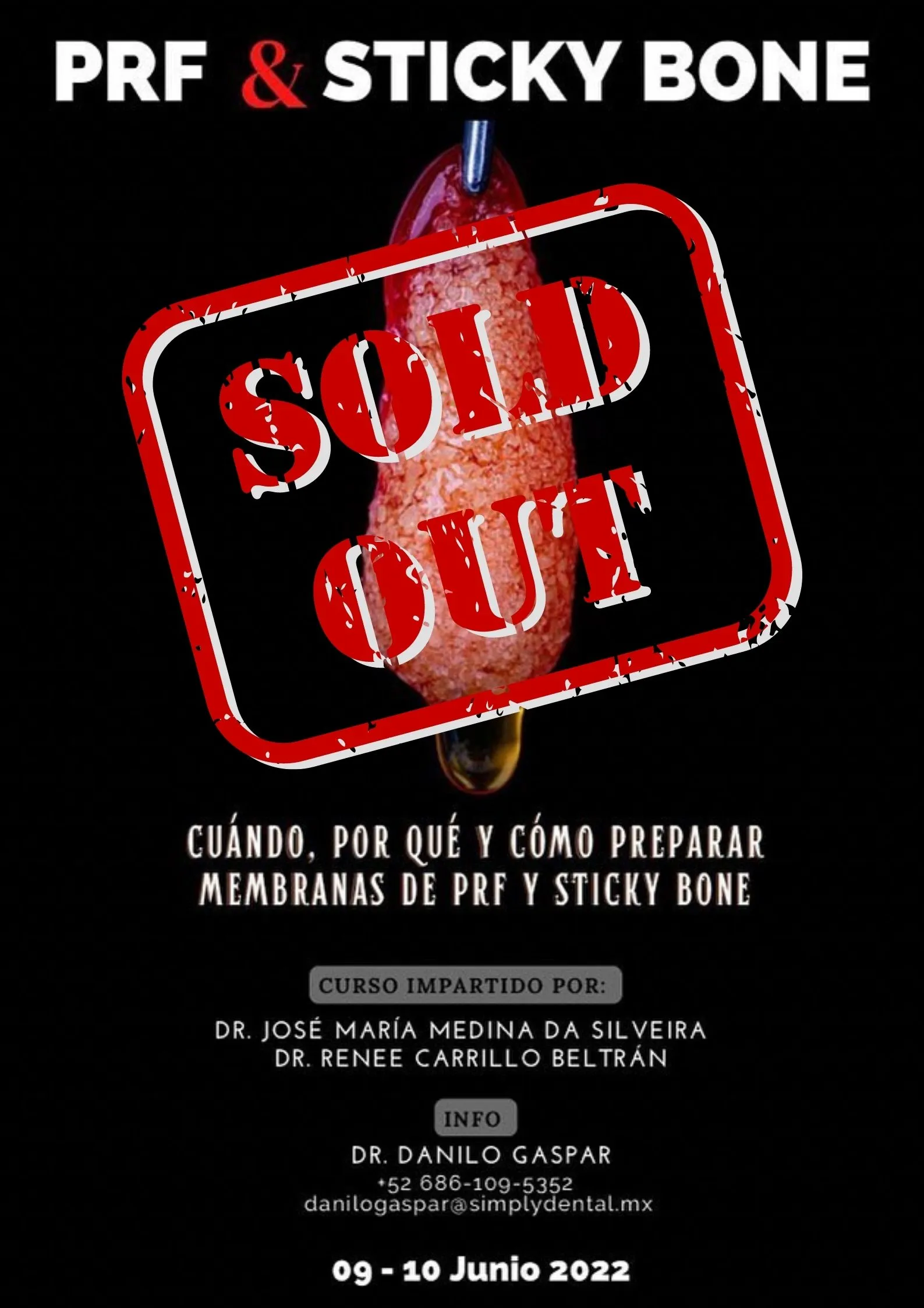 SOLD OUT 1