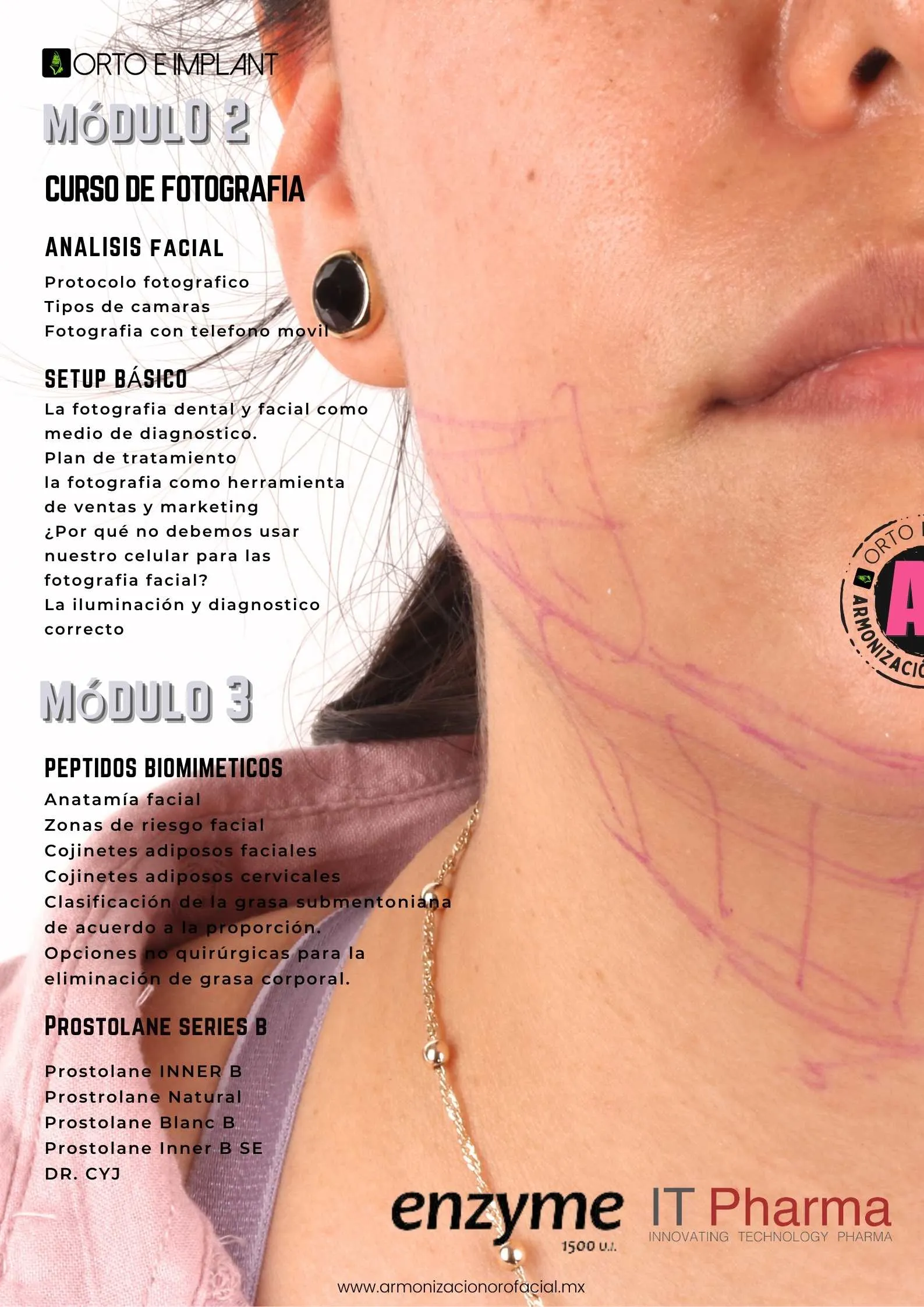 ARMONIZACION OROFACIAL